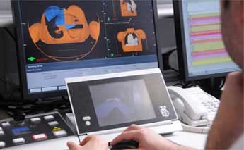 Planificacion radioterapia